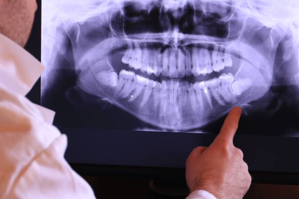 Best Emergency Dental Surgery in Rotan, TX