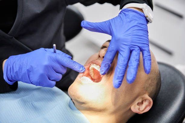 Best Emergency Tooth Extraction in Rotan, TX