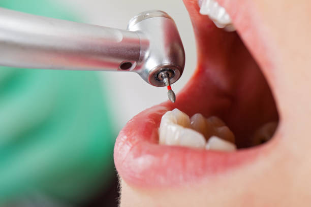 Best Emergency Treatment for Toothache in Rotan, TX